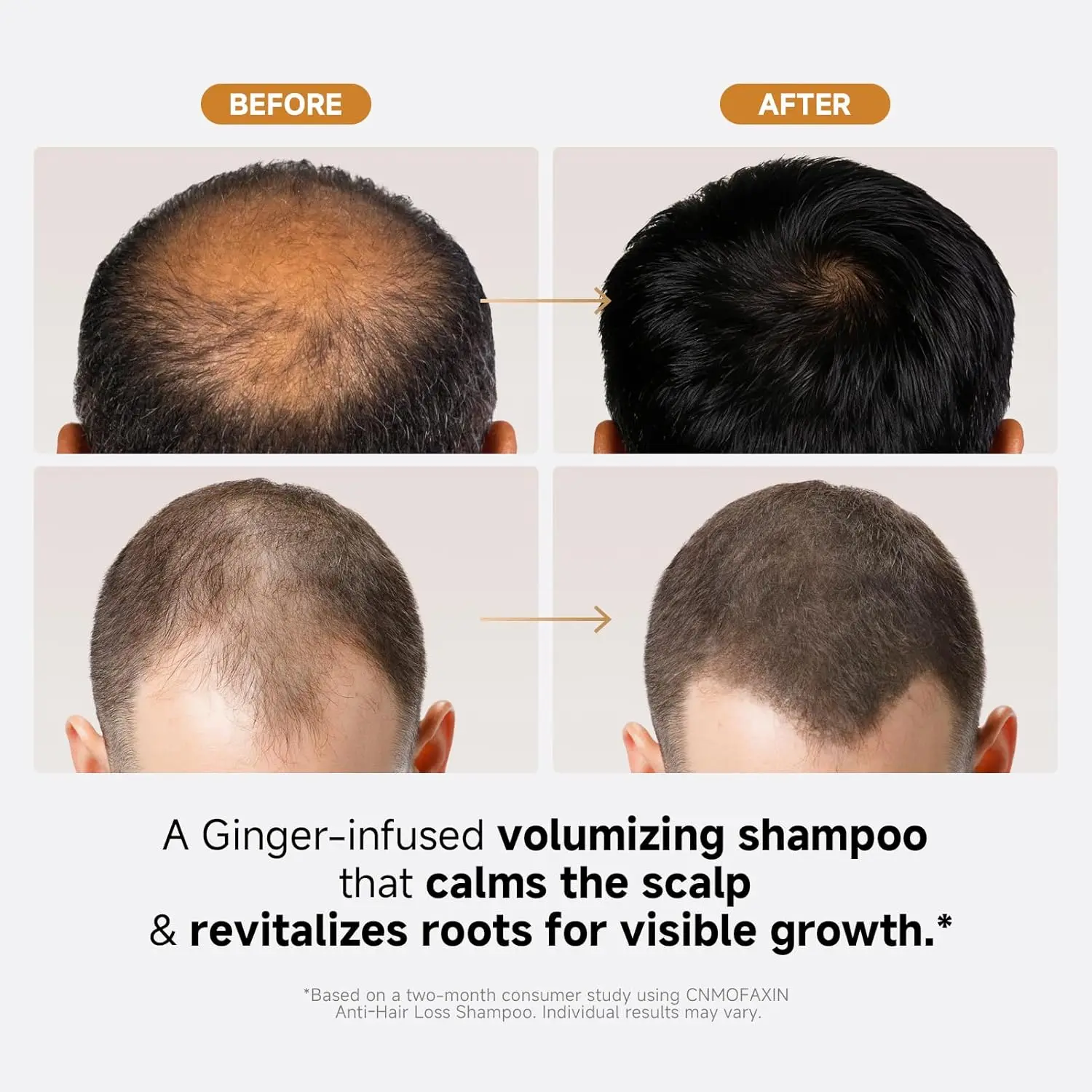 Anti hair loss shampoo with castor oil, rose oil, and ginger extract promotes hair growth, thickens hair, and soothes dry, itchy scalp for men and women.