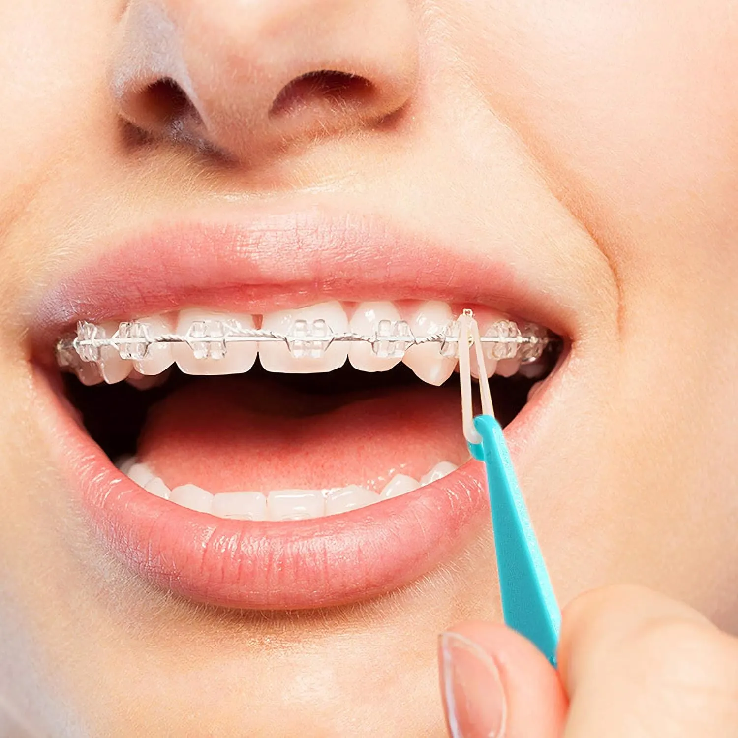 Dental Elastic Bands Placers for Braces 20 PCS - Image 6