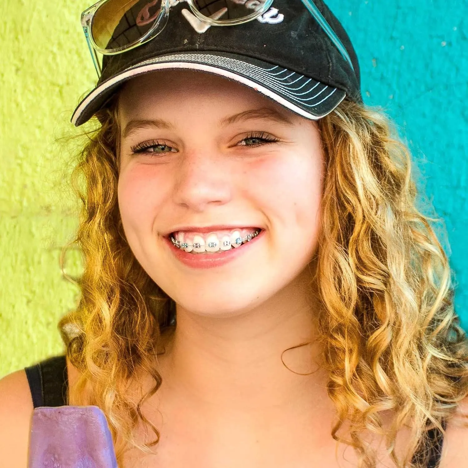 Dental Lingual Buttons Orthodontic Material 20pcs - Image 6