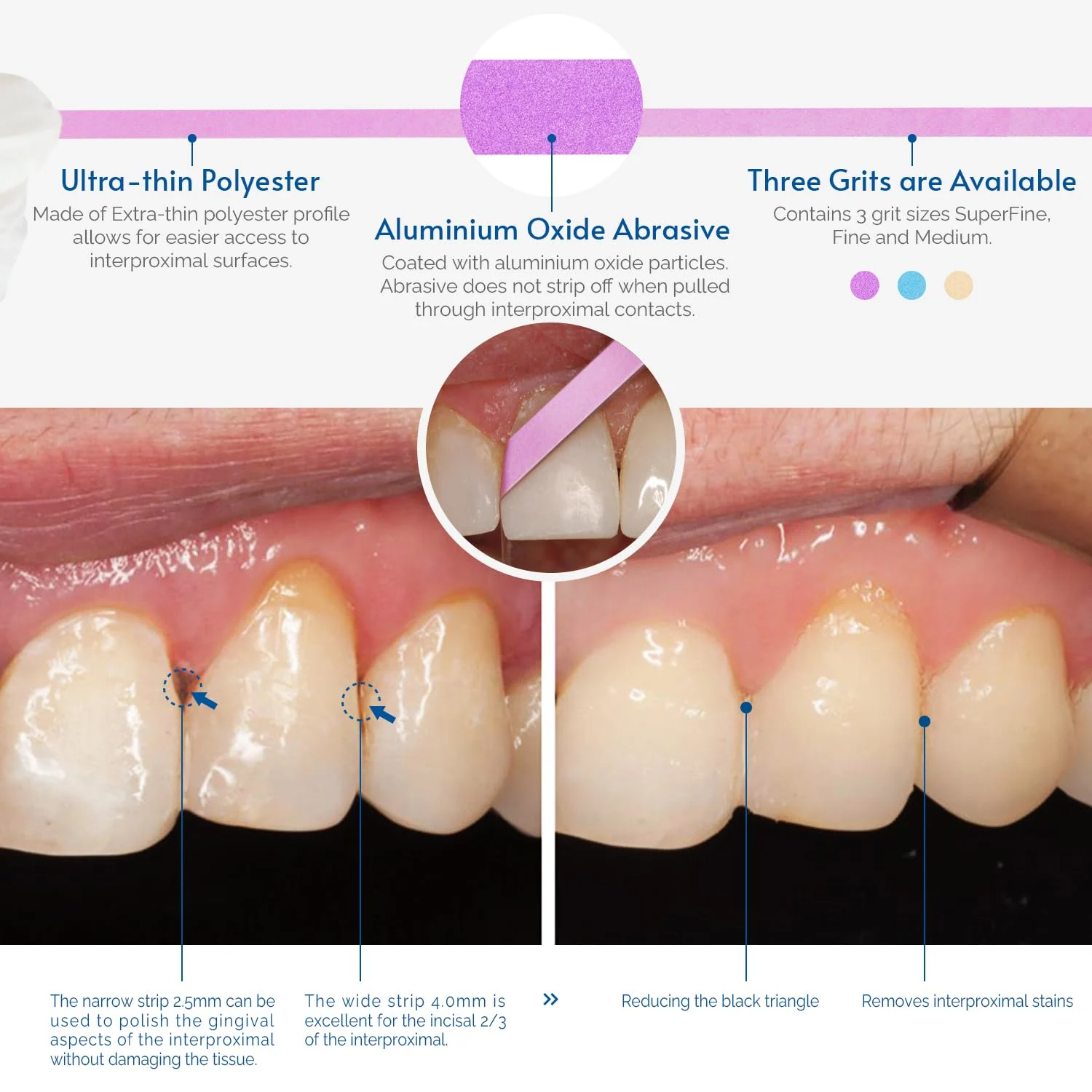 Dental Polishing Strips, Tooth Sandpaper for Resin - Image 4