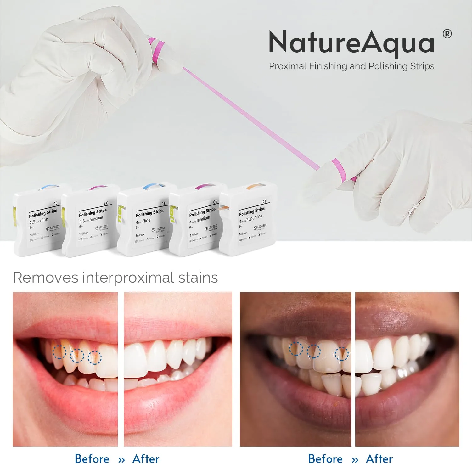 Dental Polishing Strips, Tooth Sandpaper for Resin - Image 6