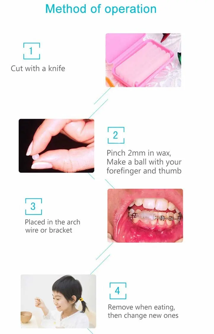 RZJZGZ Dental Wax for Braces - Gum Protection - Image 4