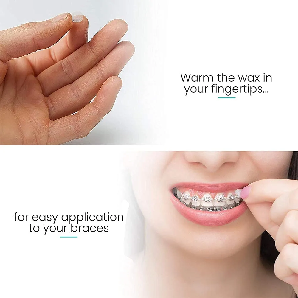 Dental Wax for Braces Mint - Orthodontic Relief - Image 2