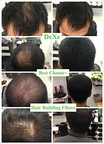 Dexe hair building fibers in black, a 22g container for concealing hair loss and thinning hair.