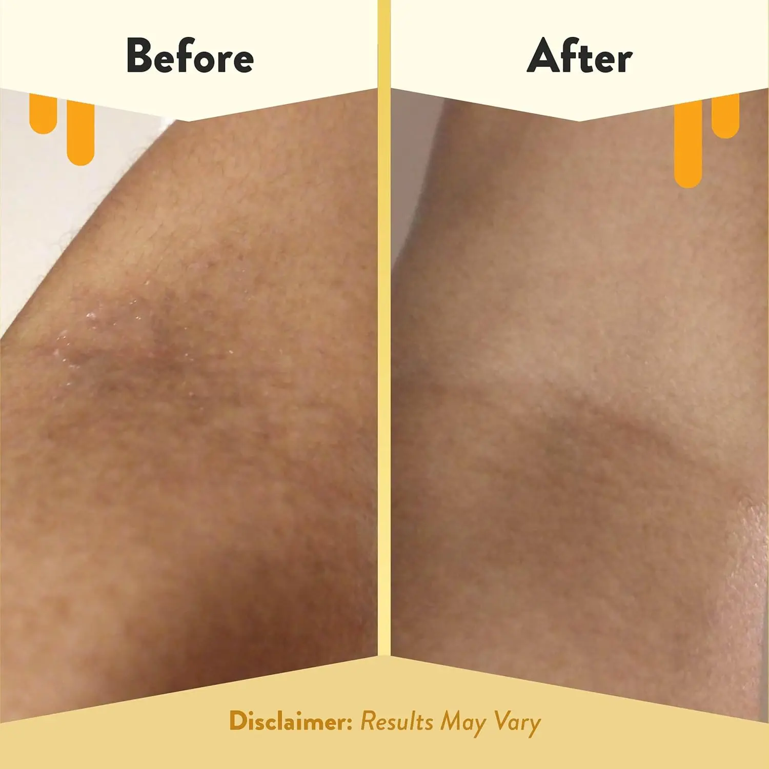 Eczema Honey fragrance-free oatmeal bubble bath gently cleanses and soothes sensitive skin, providing relief from eczema and irritation while promoting healthy, soft, and glowing skin for the whole family.