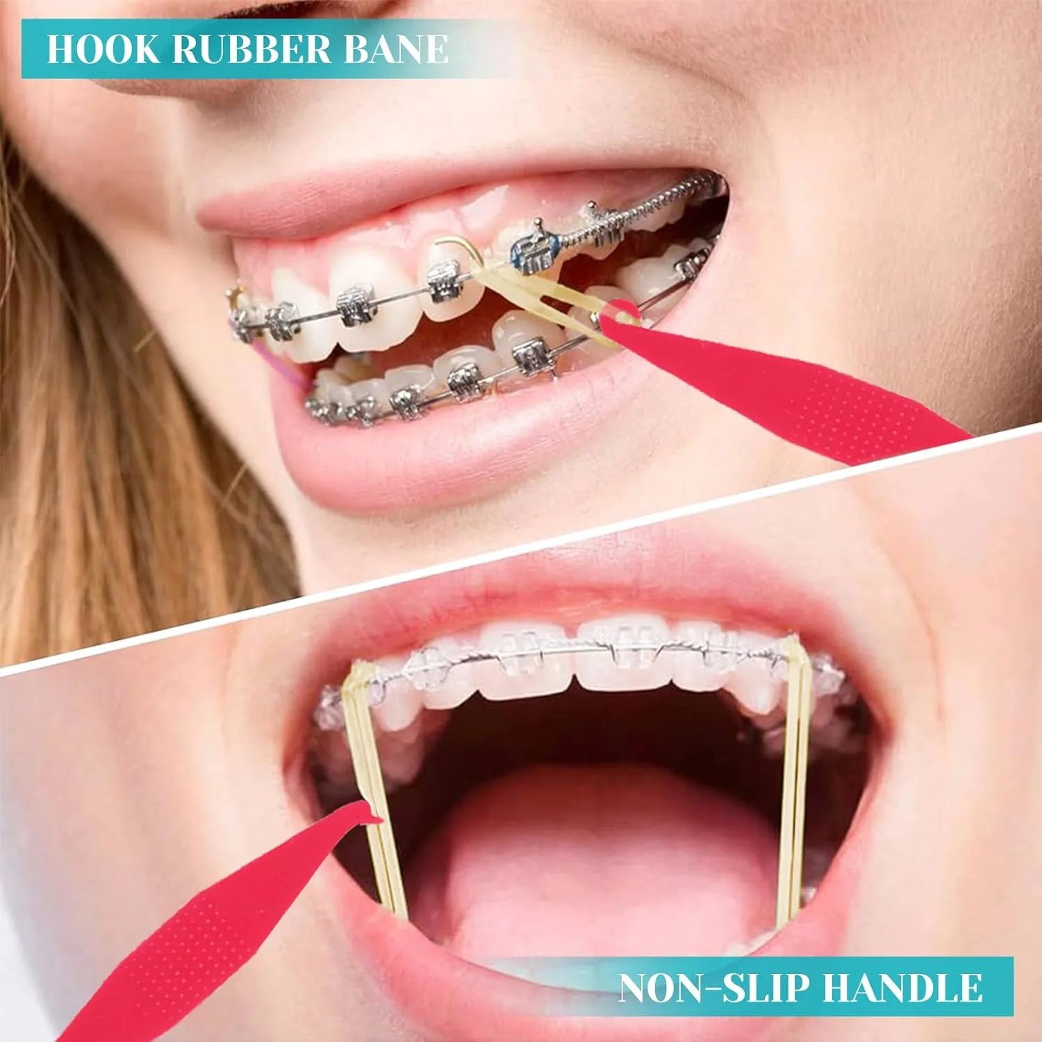 Elastic Bands Placers for Braces - 30 Pcs - Image 4