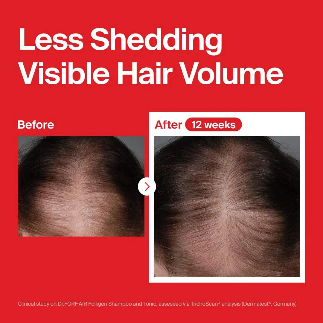 Dr.ForHair Folligen Tonic is a hair growth spray formulated with Folligen Complex to nourish the scalp, strengthen hair follicles, and promote healthy hair.