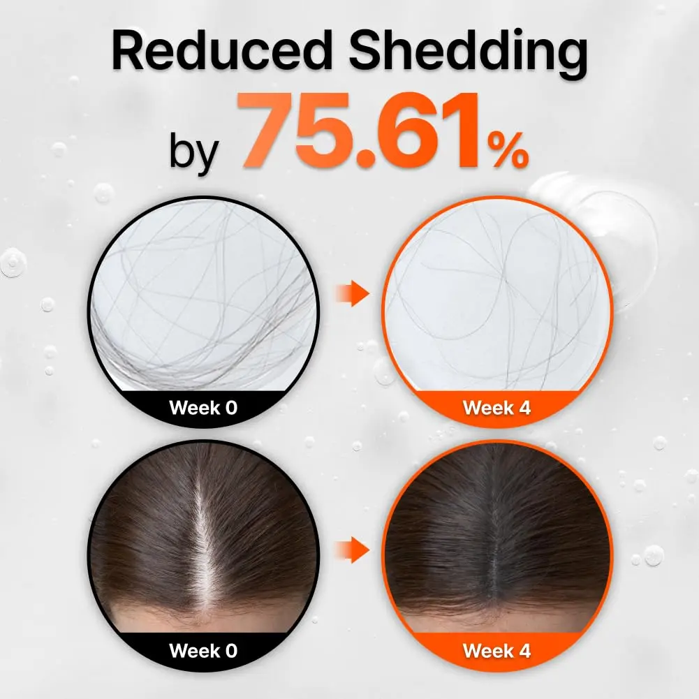 GROWTURN hair growth serum with built-in brush applicator for easy, targeted treatment of thinning hair and dry scalp.