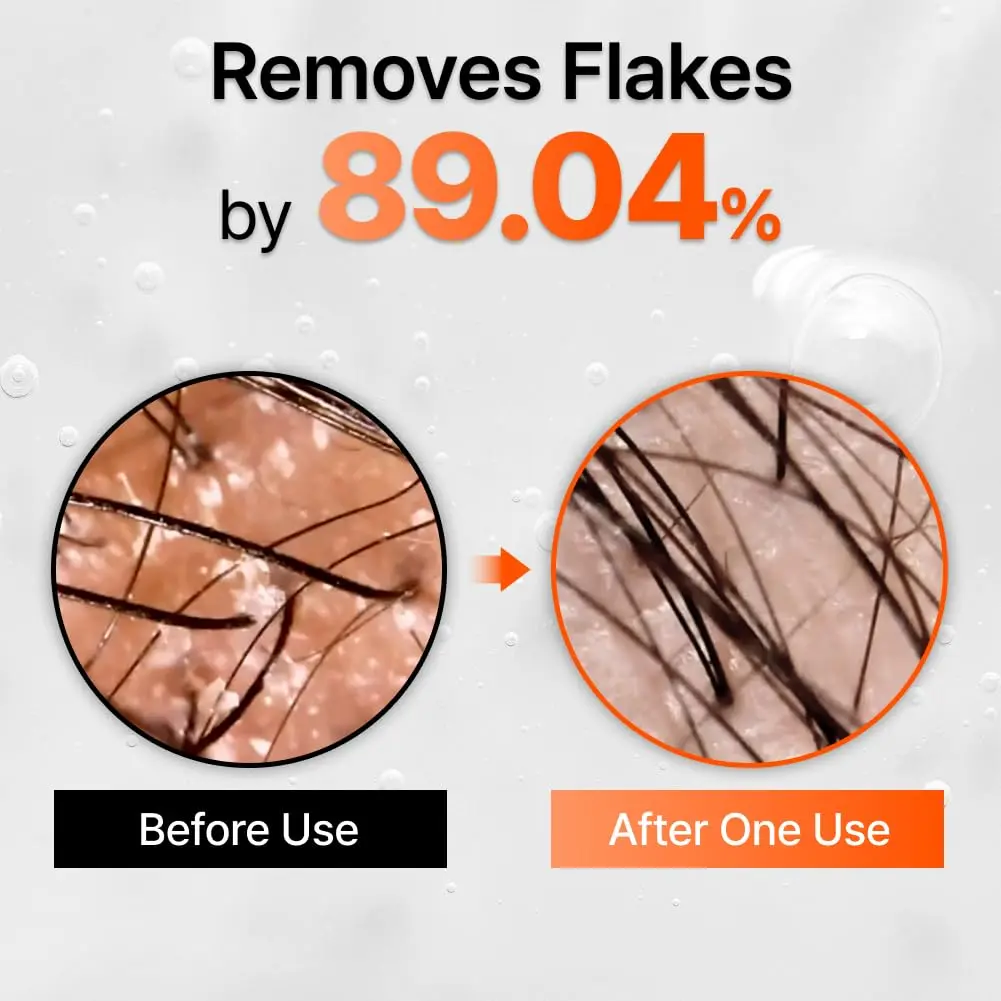 GROWTURN hair growth serum with built-in brush applicator for easy, targeted treatment of thinning hair and dry scalp.