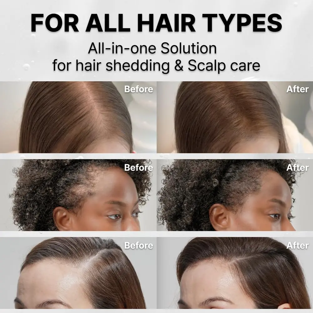 GROWTURN hair growth serum with built-in brush applicator for easy, targeted treatment of thinning hair and dry scalp.