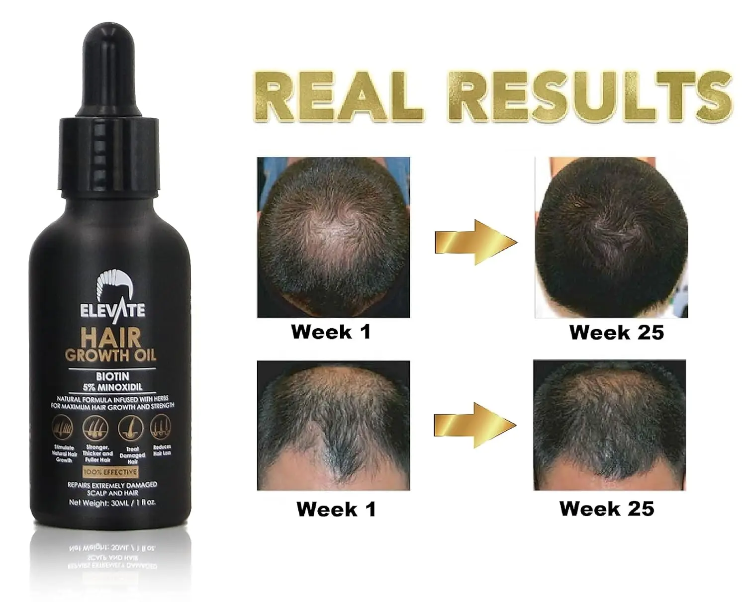 ELEVATE hair growth oil with biotin and 5% minoxidil promotes stronger, thicker, and longer hair for men and women by revitalizing the scalp and preventing hair loss.