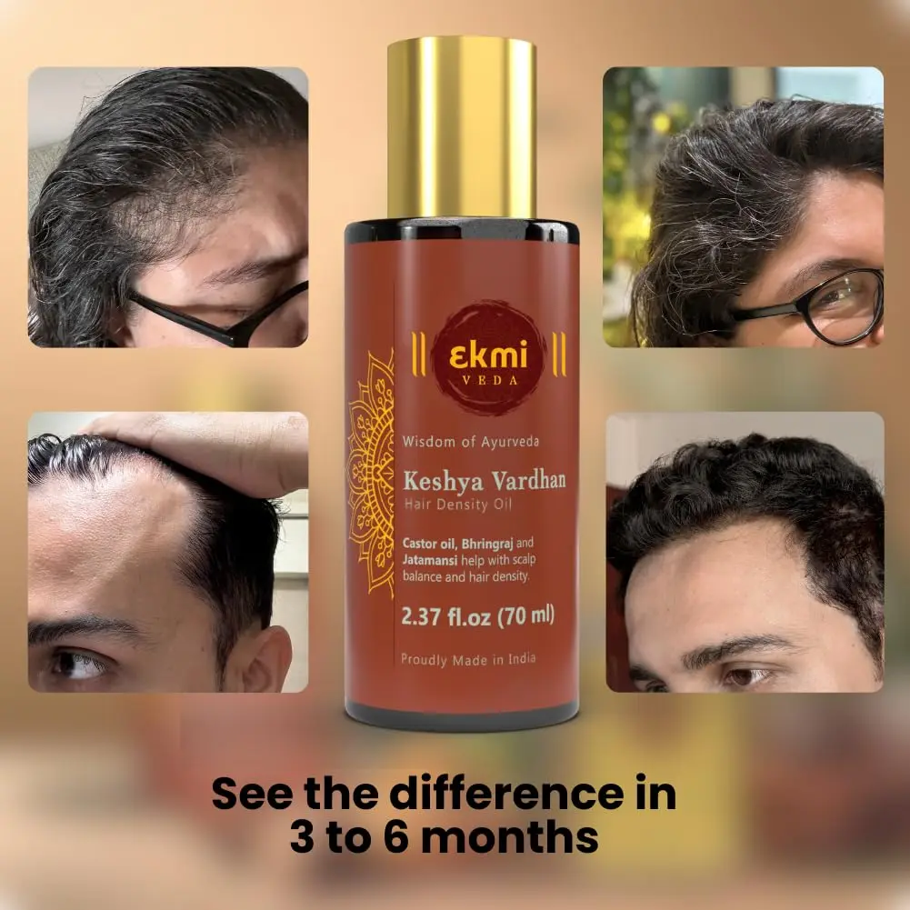 Ayurvedic hair growth oil infused with rosemary, castor, and bhringraj in a bottle, designed to promote hair density and prevent hair loss for both women and men.