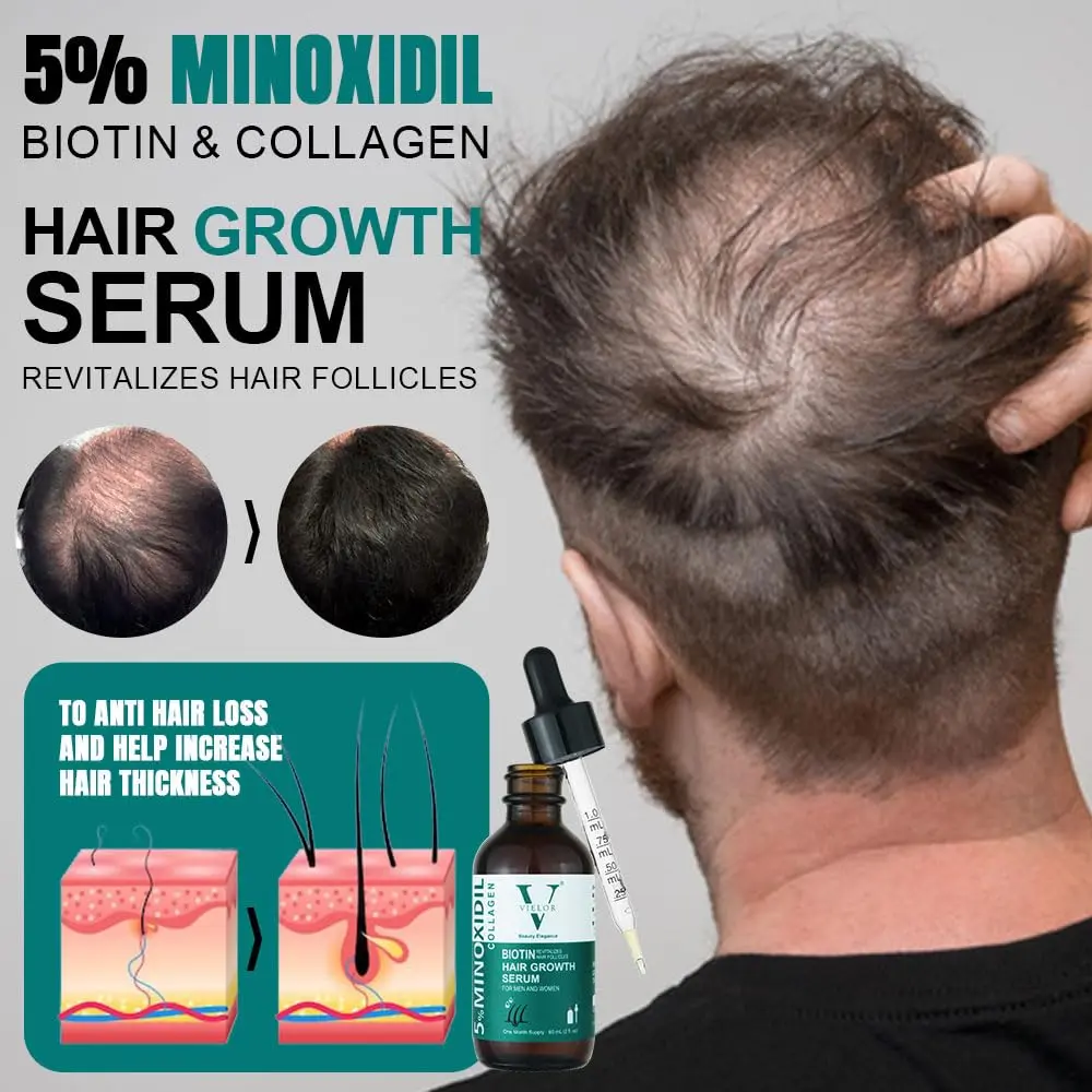 Advanced hair growth serum with 5% minoxidil, biotin, and collagen to help thicken hair, support scalp health, and reduce hair loss for both men and women.