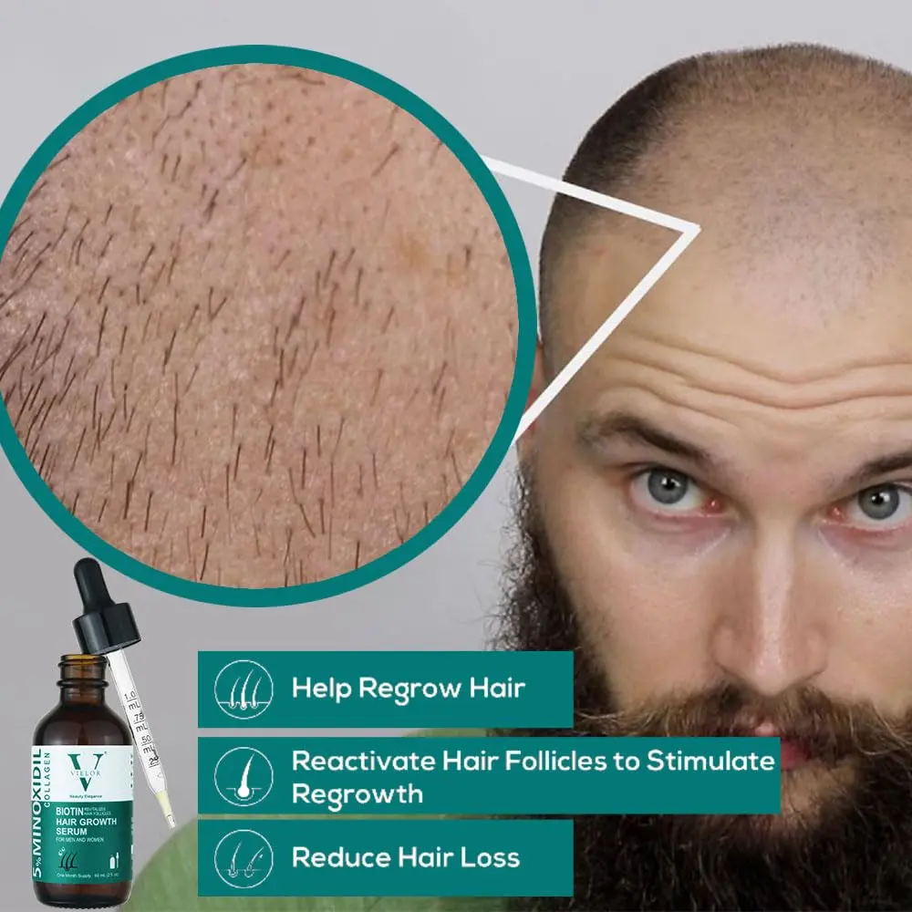 Advanced hair growth serum with 5% minoxidil, biotin, and collagen to help thicken hair, support scalp health, and reduce hair loss for both men and women.