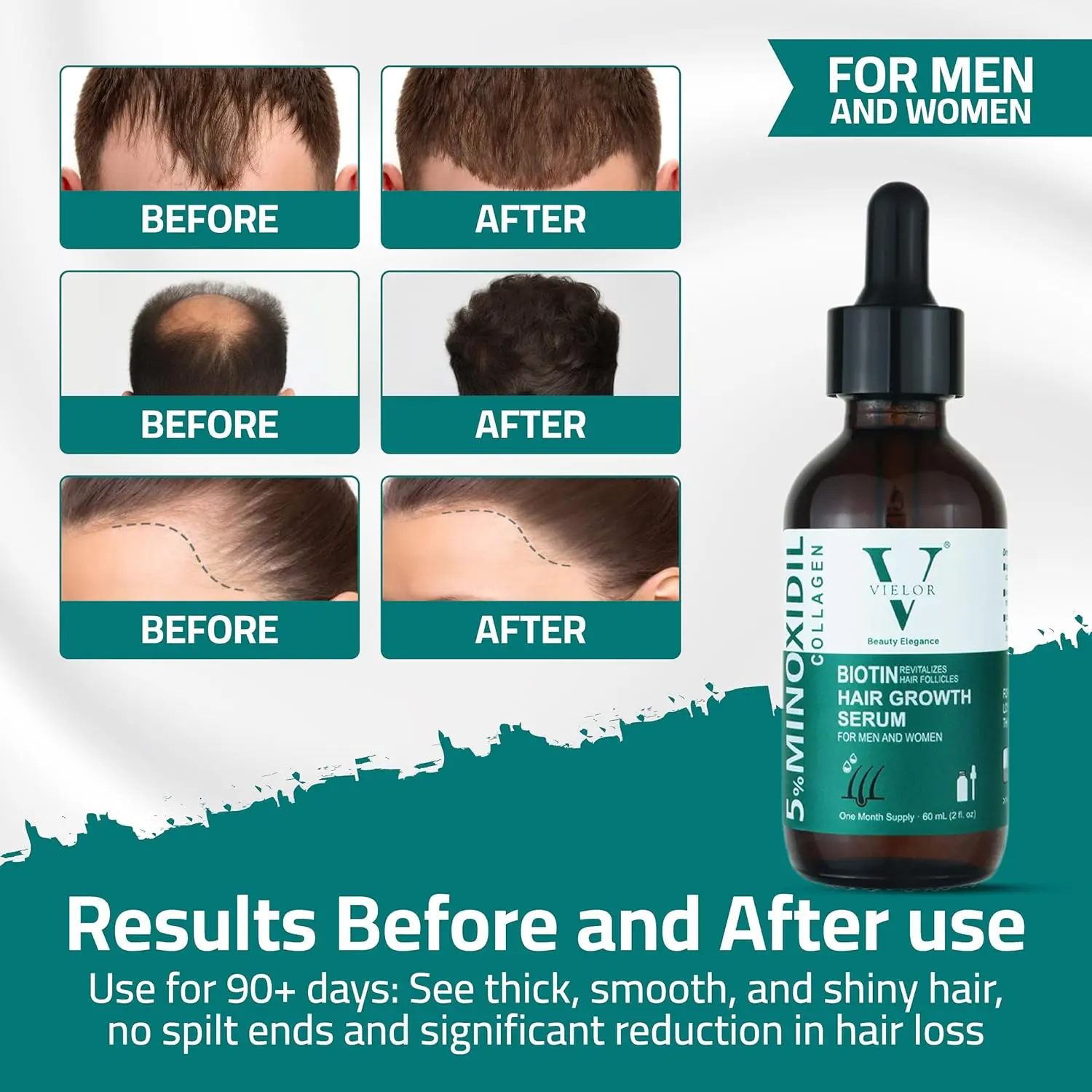Advanced hair growth serum with 5% minoxidil, biotin, and collagen to help thicken hair, support scalp health, and reduce hair loss for both men and women.