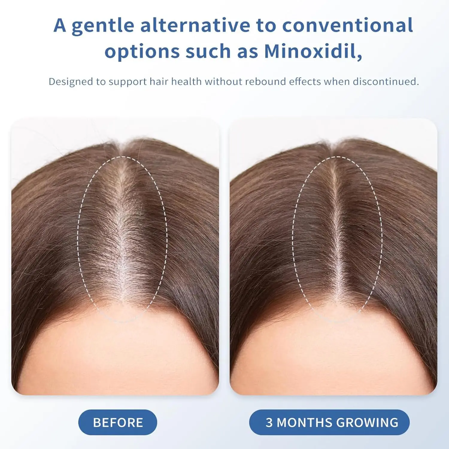 This hair growth serum roll on with redensyl and rosemary oil stimulates hair follicles to reduce thinning and promote thicker, healthier hair for both men and women.