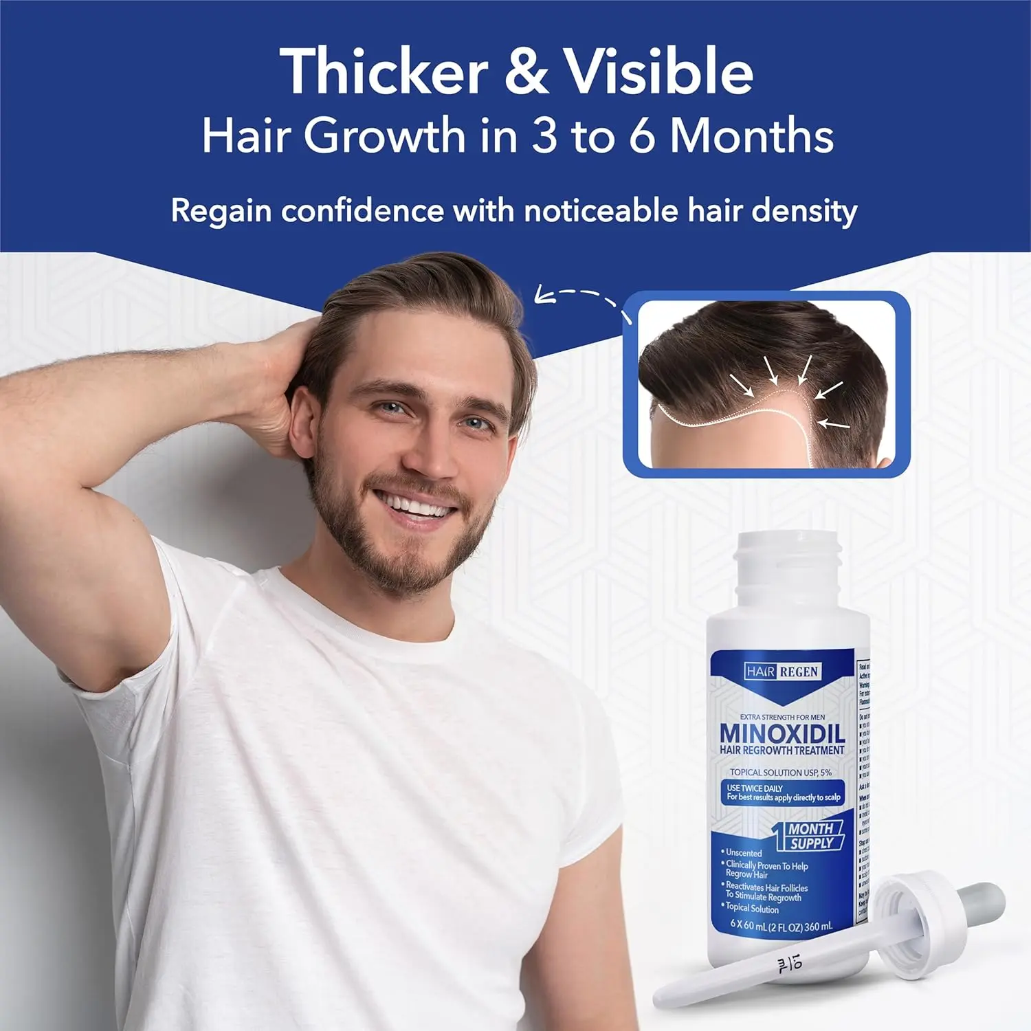 Six bottles of Hair Regen 5% minoxidil topical solution with a derma roller for men's hair regrowth treatment to combat thinning hair and hair loss.