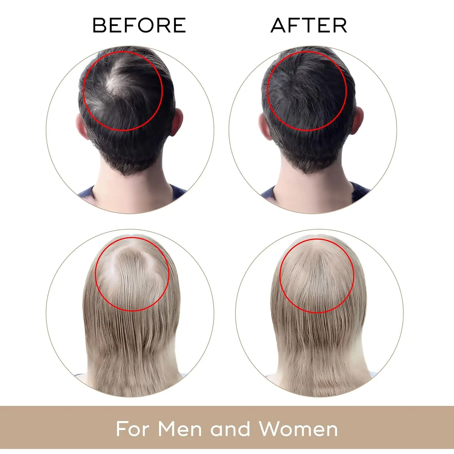 USA Dekohair hair regrowth serum promotes hair growth, increases hair thickness, and helps stop hair thinning for a fuller, healthier head of hair.