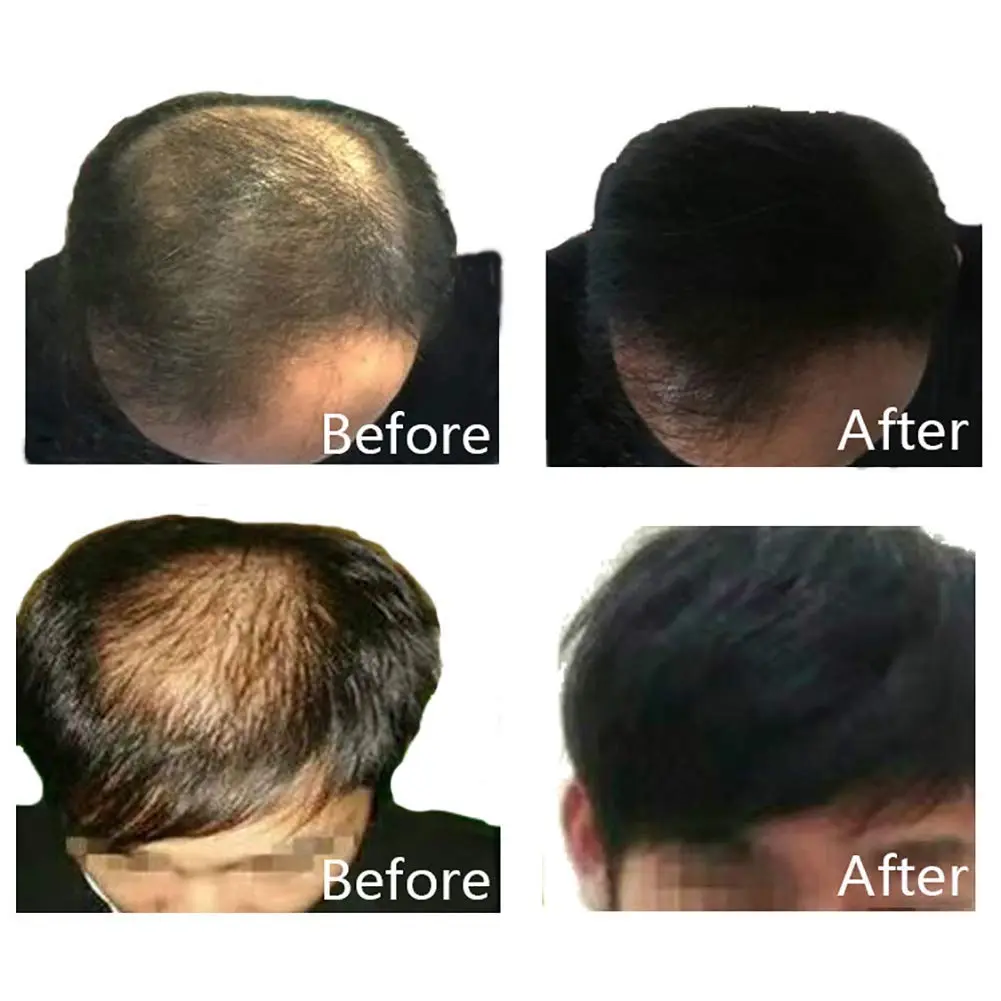 This image shows black hair thickening fibers, a hair loss treatment for men and women who want to achieve natural, thick, beautiful-looking hair with just one application.