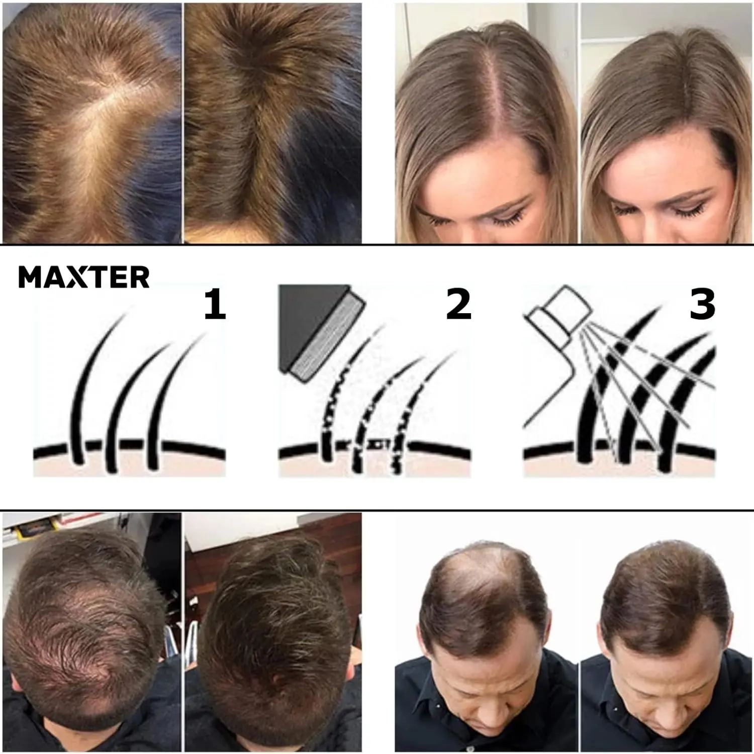 Maxter hair fibers in medium brown color instantly cover thinning hair and bald spots, creating a fuller, thicker look for both men and women.