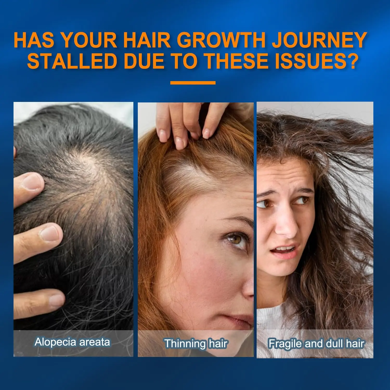 This 5% minoxidil foam treatment, formulated with biotin and castor oil, helps men and women regrow thicker, fuller hair while strengthening and revitalizing thinning strands.