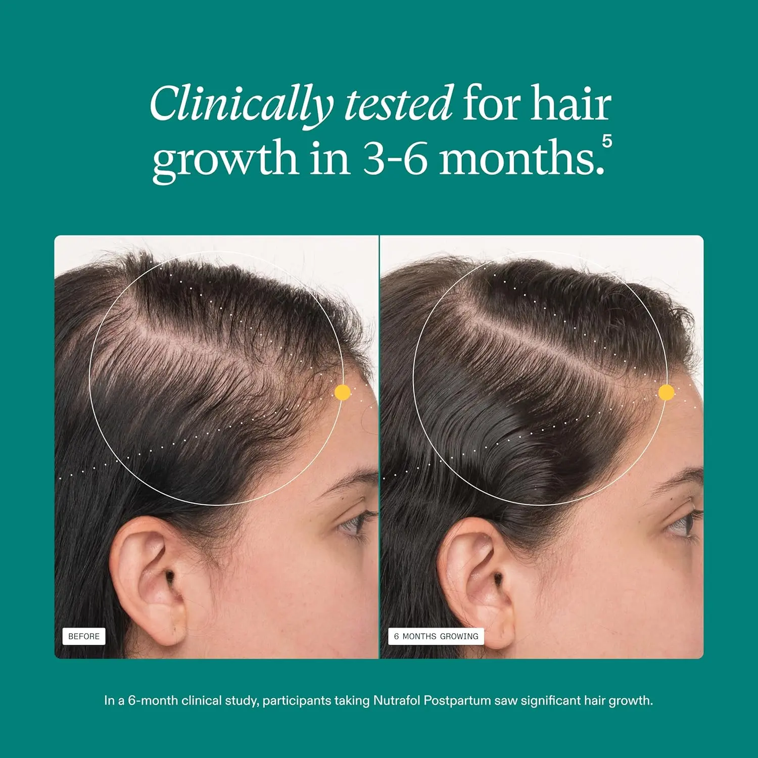 One-month supply of Nutrafol Postpartum hair growth supplement formulated with breastfeeding-friendly ingredients for visibly thicker, stronger hair after childbirth.