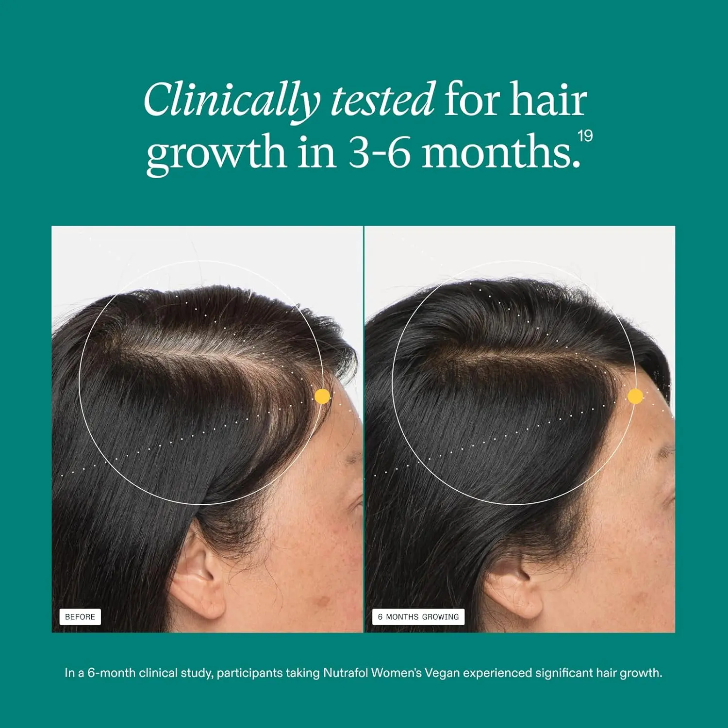 One bottle of Nutrafol Women's Vegan Hair Growth Supplements for visibly thicker, stronger hair in 3-6 months.