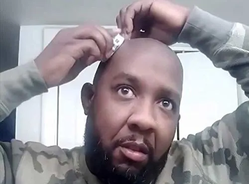 OmniShaver - Head Shaver Bald Head Razor for Men & Women - Image 4