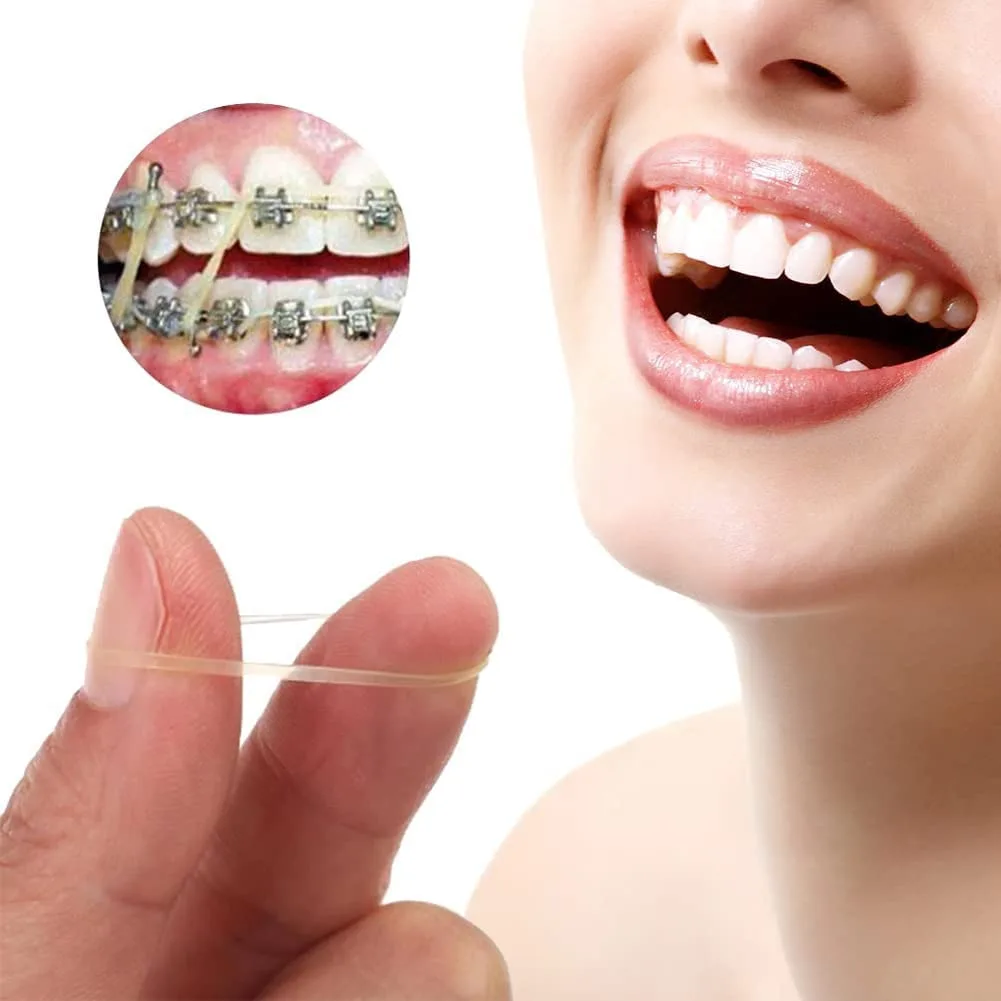 Orthodontic Elastics Bands, 300 Pcs - Image 5