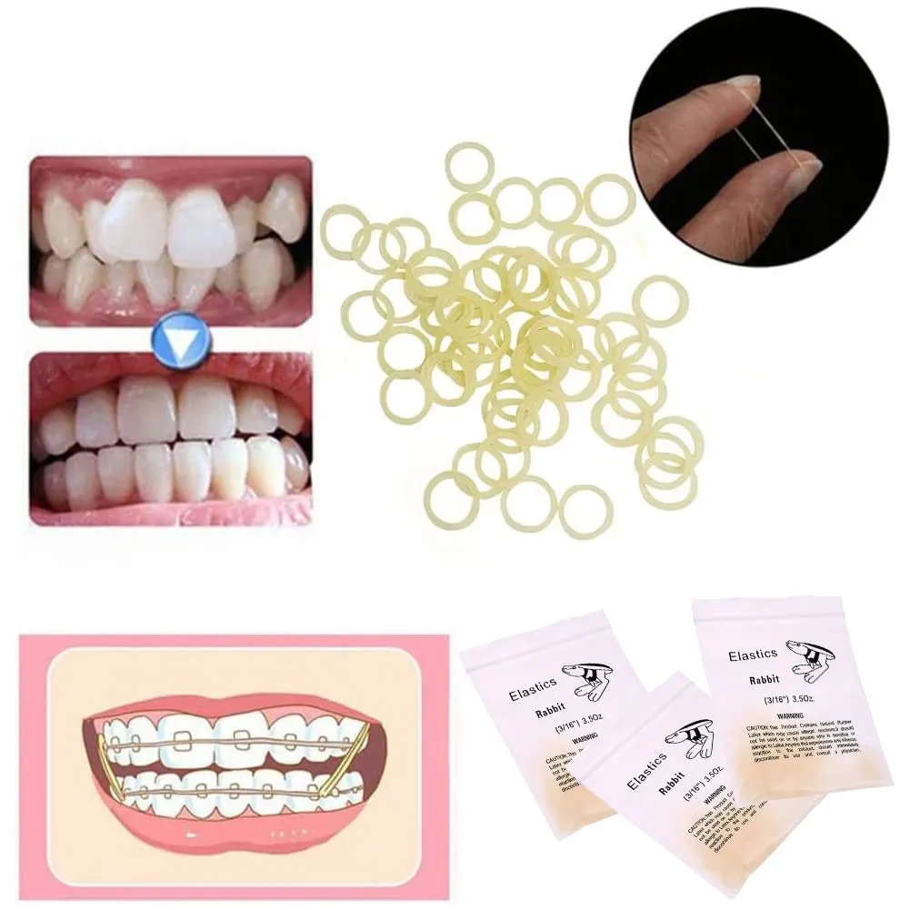 Orthodontic Elastics Bands, 300 Pcs - Image 6
