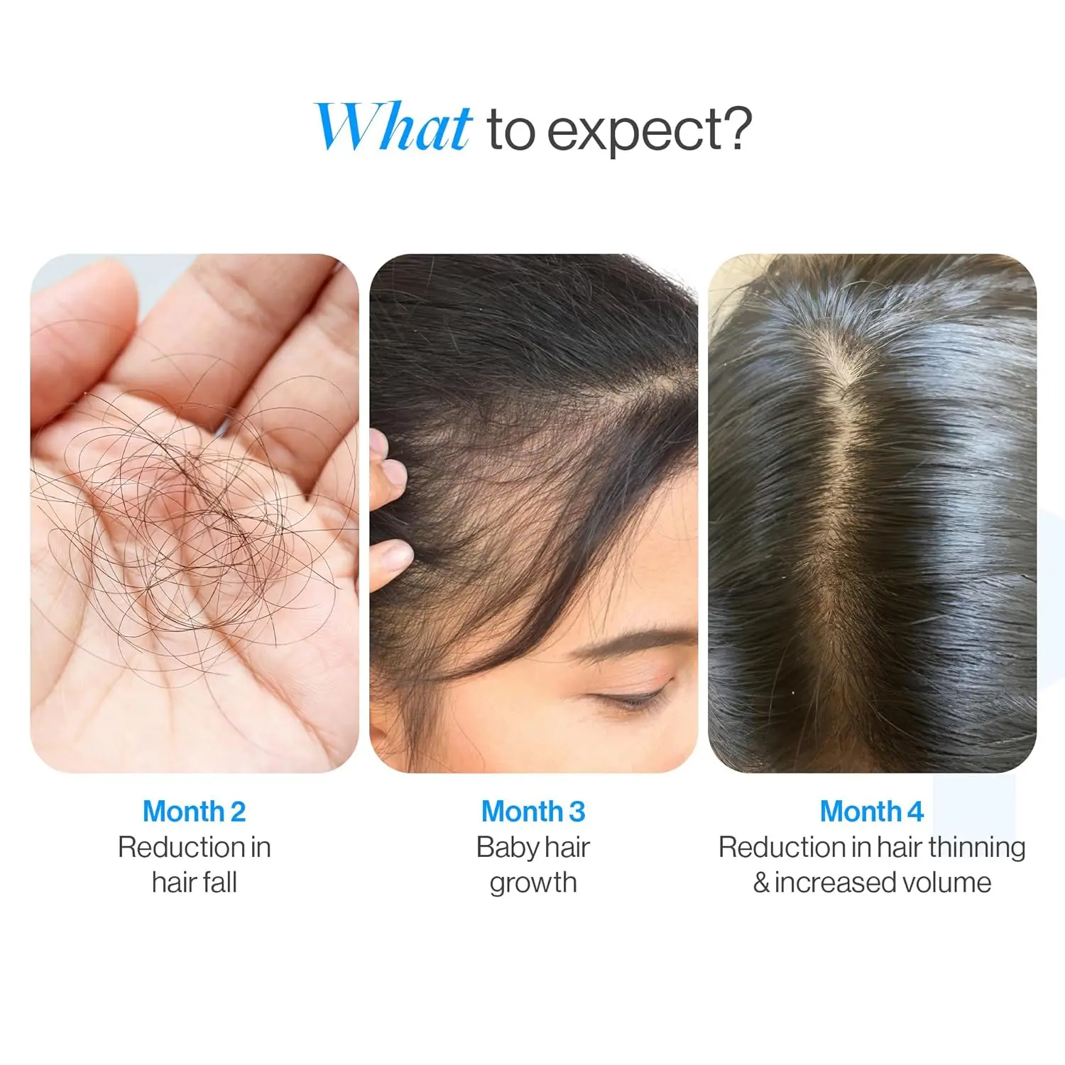 Be Bodywise rosemary hair growth serum roll on, containing Redensyl and Anagain, stimulates hair follicles for men and women, and controls hair fall while improving hair density.