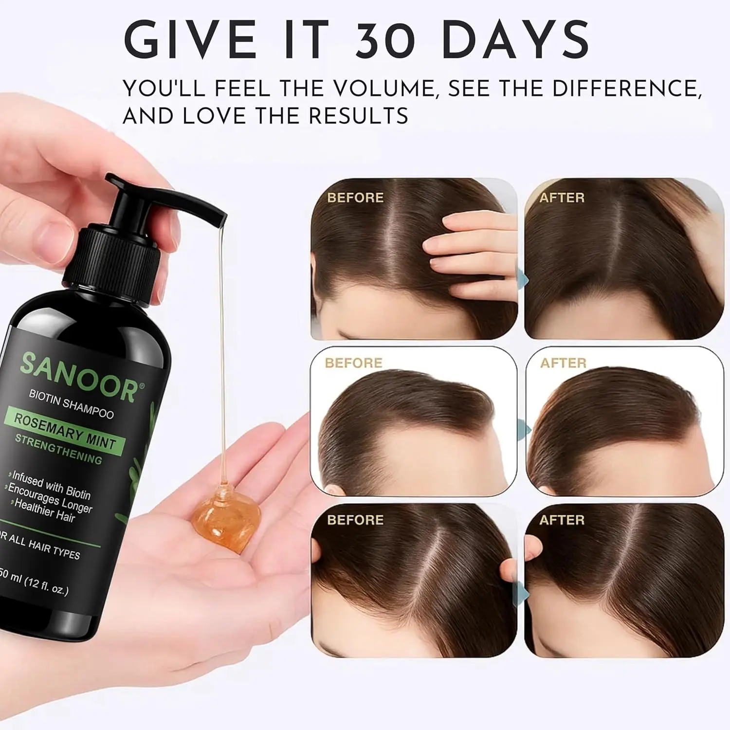 Sanoor rosemary mint shampoo infused with biotin promotes hair growth, reduces dandruff, and soothes itchy scalp, ideal for all hair types.