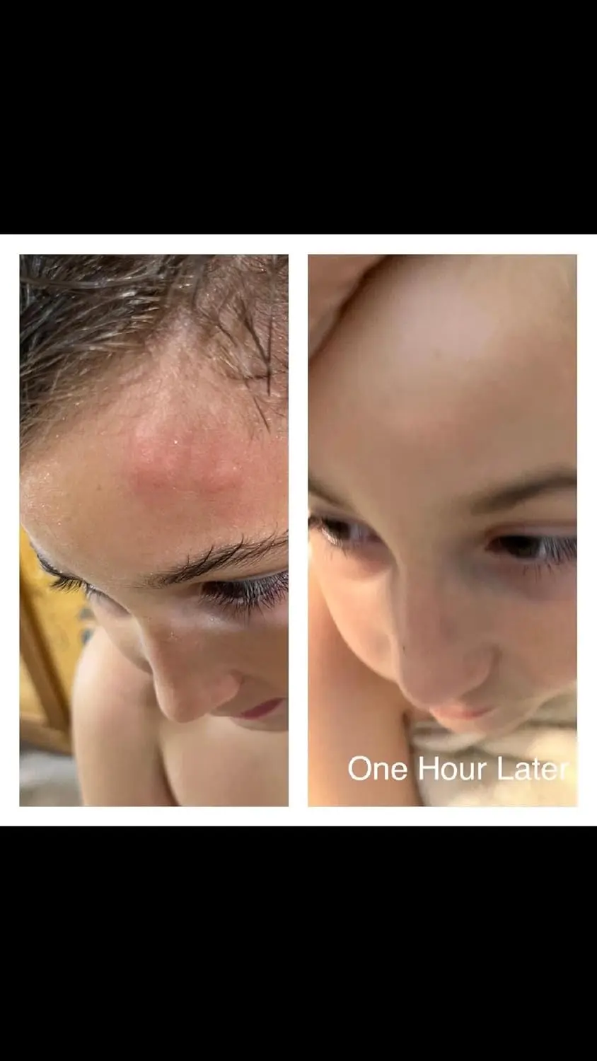 SIANI probiotic spray made with organic ingredients providing relief from skin irritations, acne, eczema, and more for kids and teens.