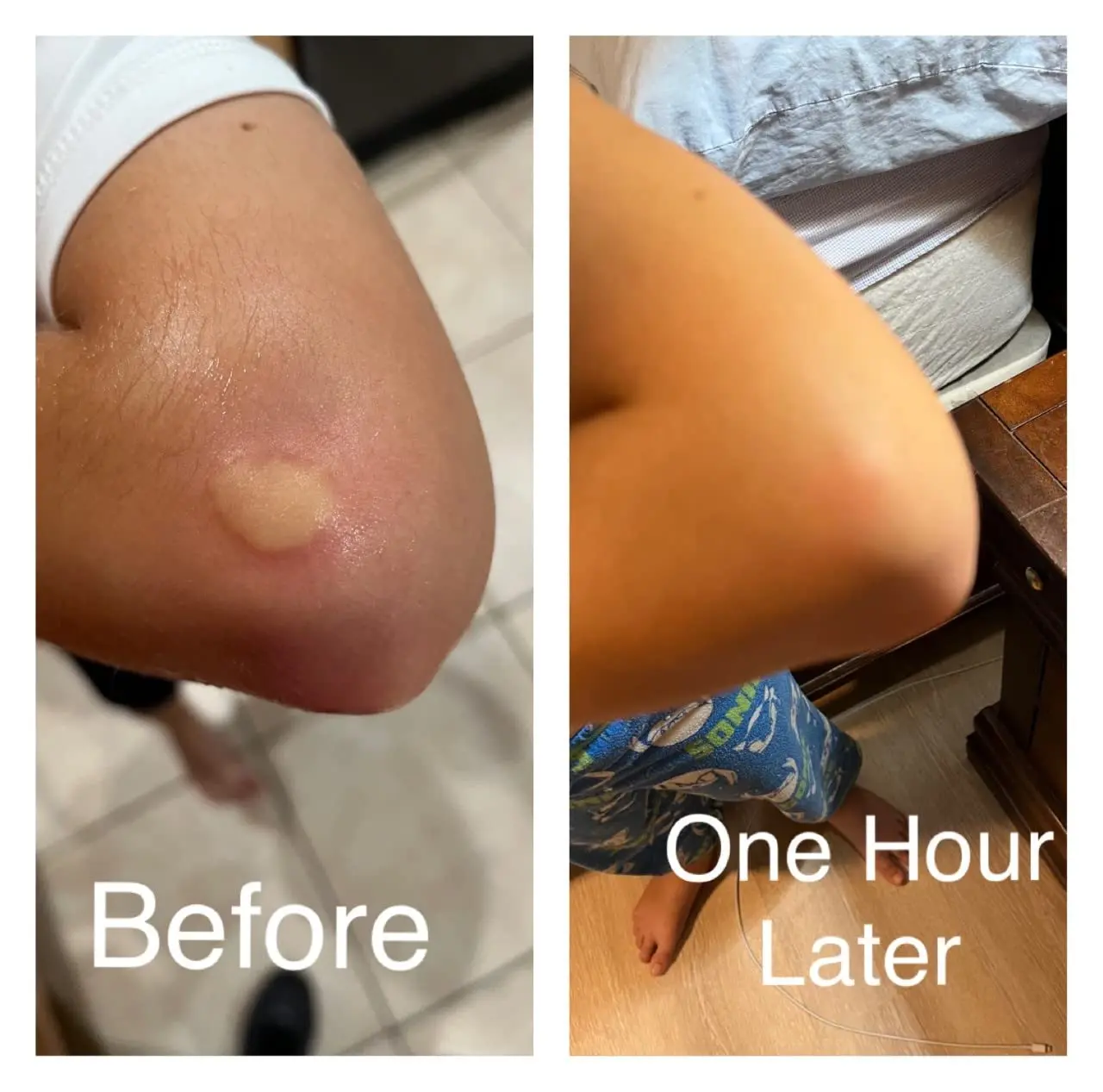 SIANI probiotic spray made with organic ingredients providing relief from skin irritations, acne, eczema, and more for kids and teens.