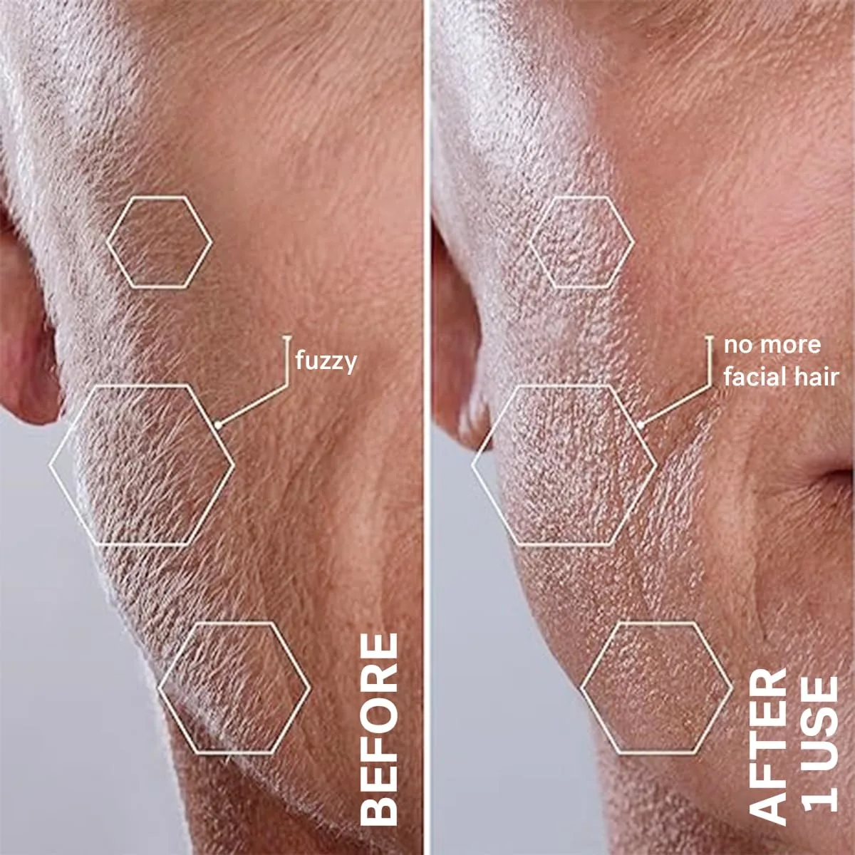 Sonicsmooth Pro - Dermaplaning Tool for Women - Image 6