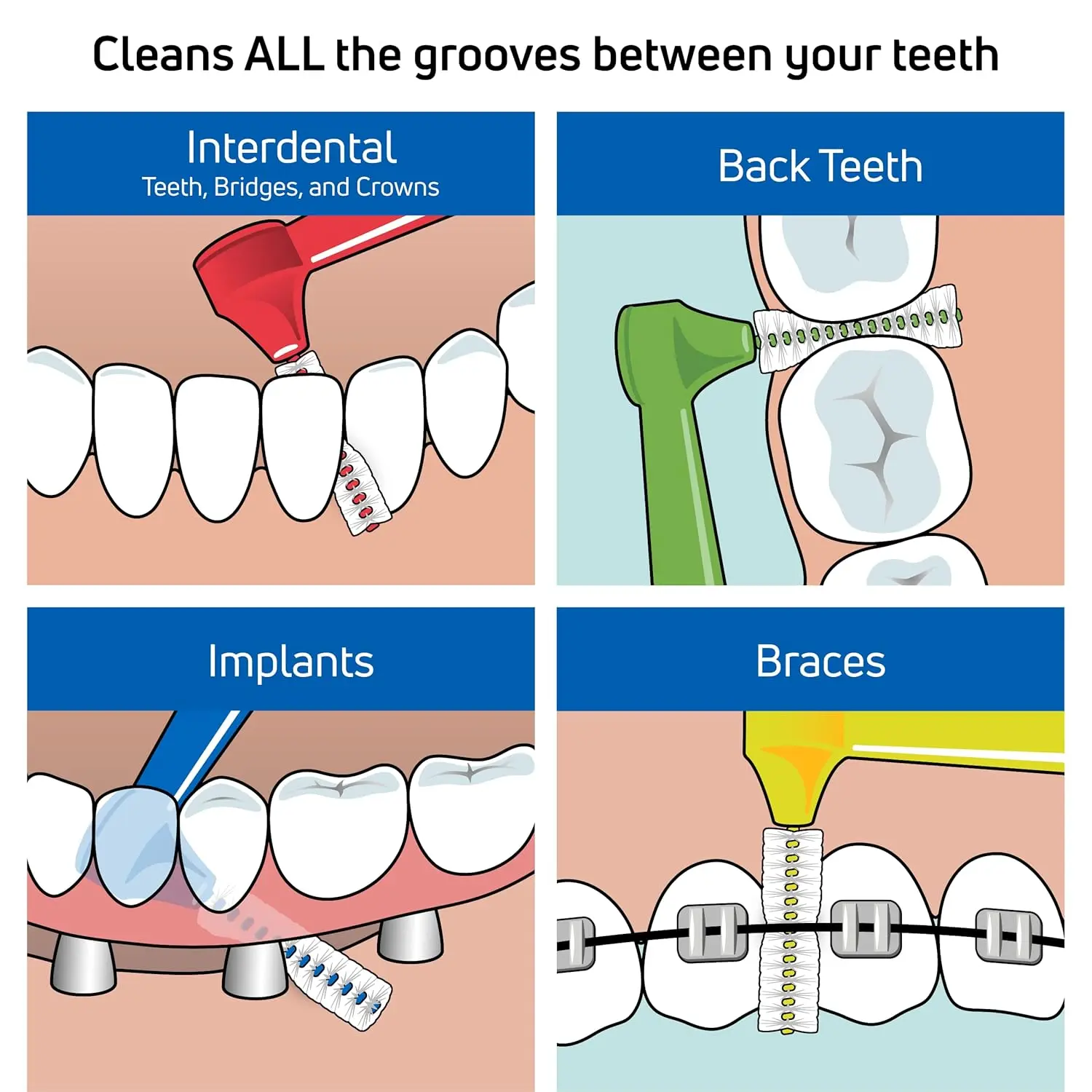 A mixed pack of TePe Angle interdental brushes in various sizes for cleaning between teeth and promoting gum health.
