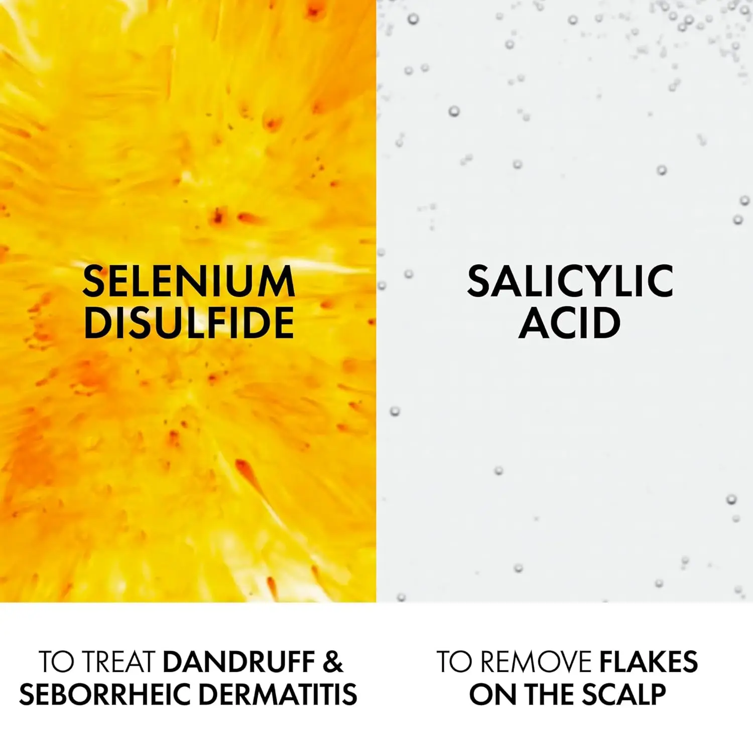 Vichy Dercos anti-dandruff shampoo for oily hair, eliminating visible flakes, intensely soothing itch, and preventing recurrence.