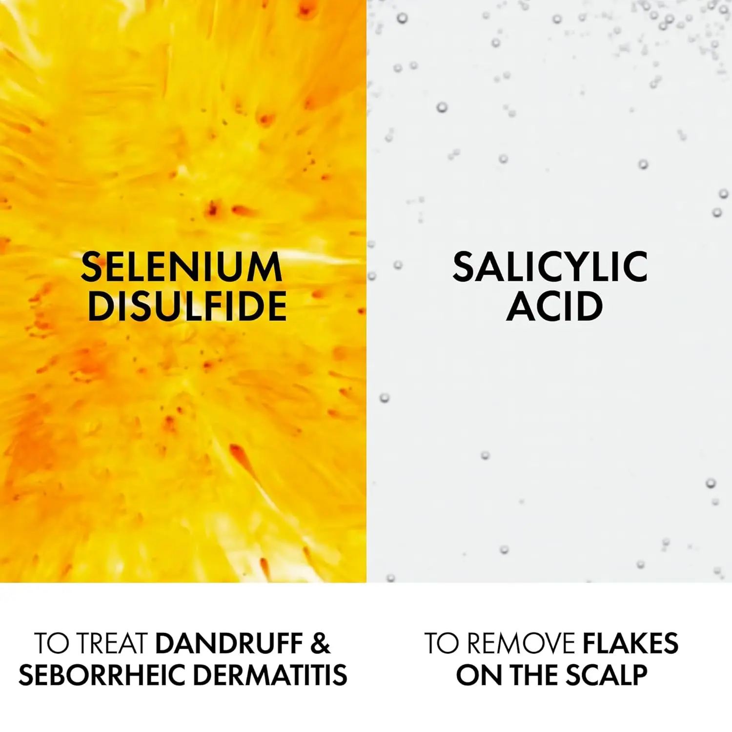 Bottle of Vichy Dercos Anti Dandruff Shampoo for Dry Hair, formulated to rebalance the scalp, eliminate dandruff, soothe itching and prevent recurrence.