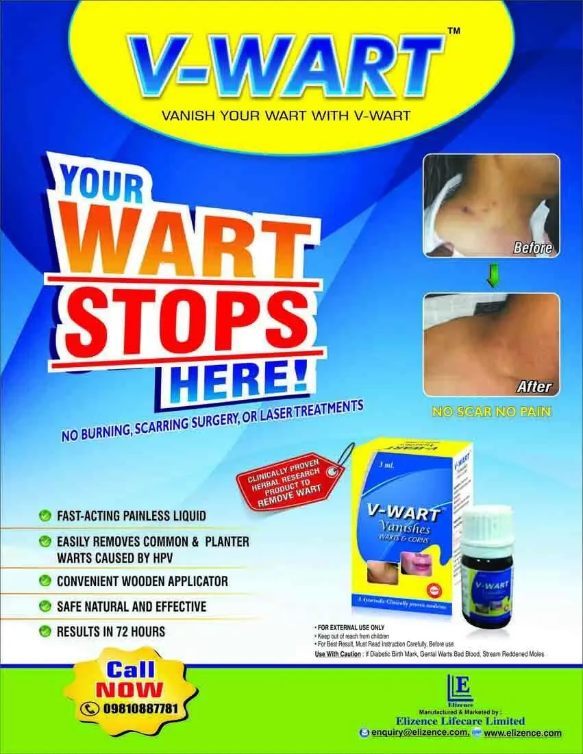 Three bottles of VWART wart and corn remover liquid with wooden applicator for effective and painless treatment of common and plantar warts.