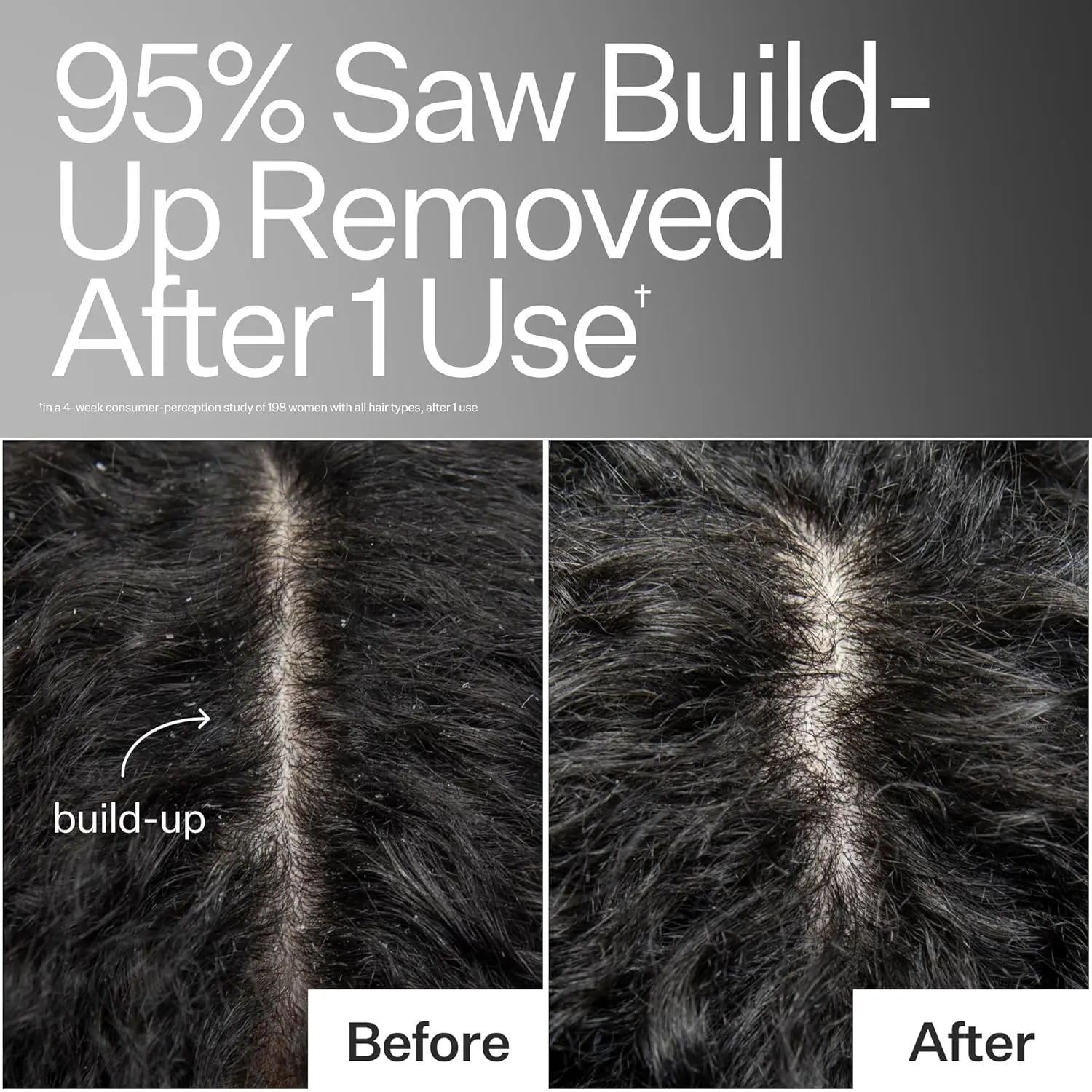 ACT+ACRE scalp detox for removing buildup and nourishing hair follicles.