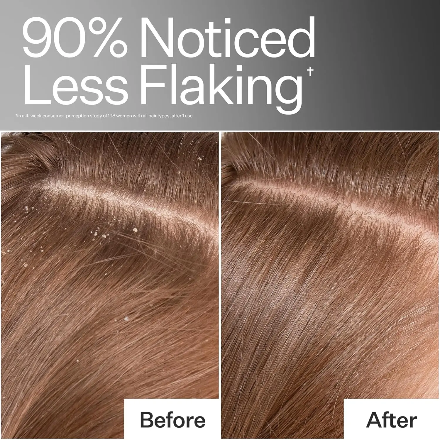 ACT+ACRE scalp detox for removing buildup and nourishing hair follicles.