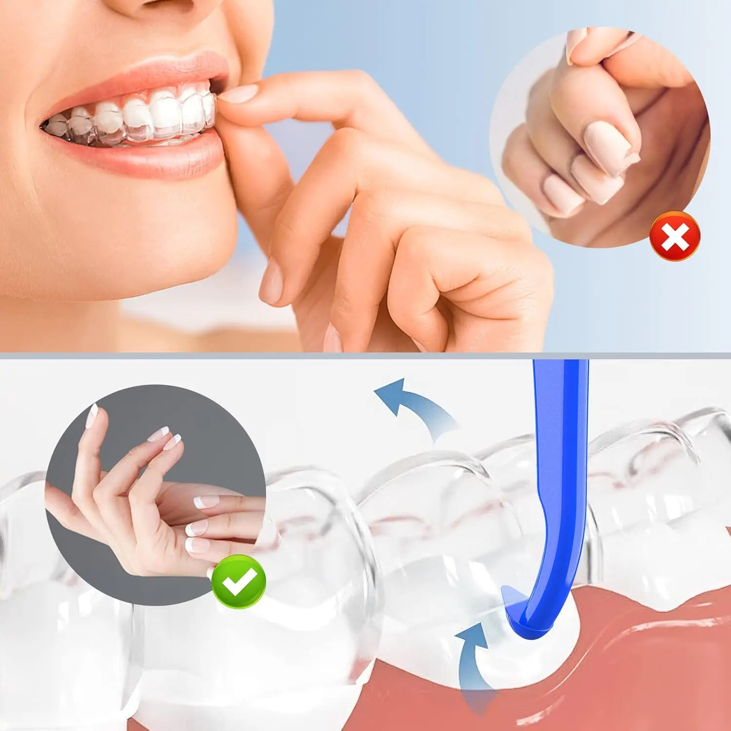 ARGOMAX aligner removal tool in blue, designed for easy and hygienic removal of invisible braces, retainers, and other orthodontic appliances.