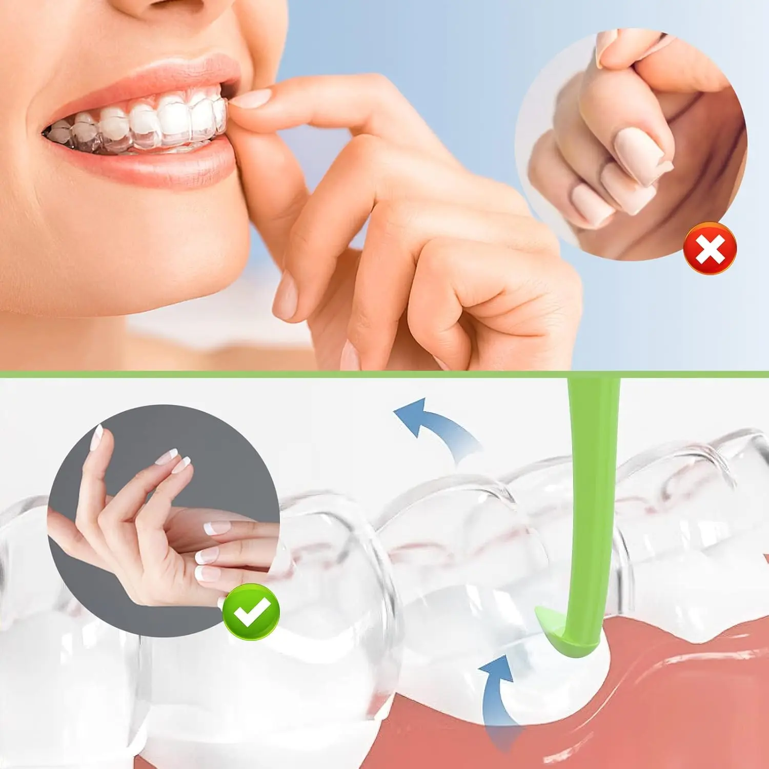 This green ARGOMAX aligner removal tool is designed for easy and hygienic removal of invisible braces, trays, retainers, dentures and aligners.