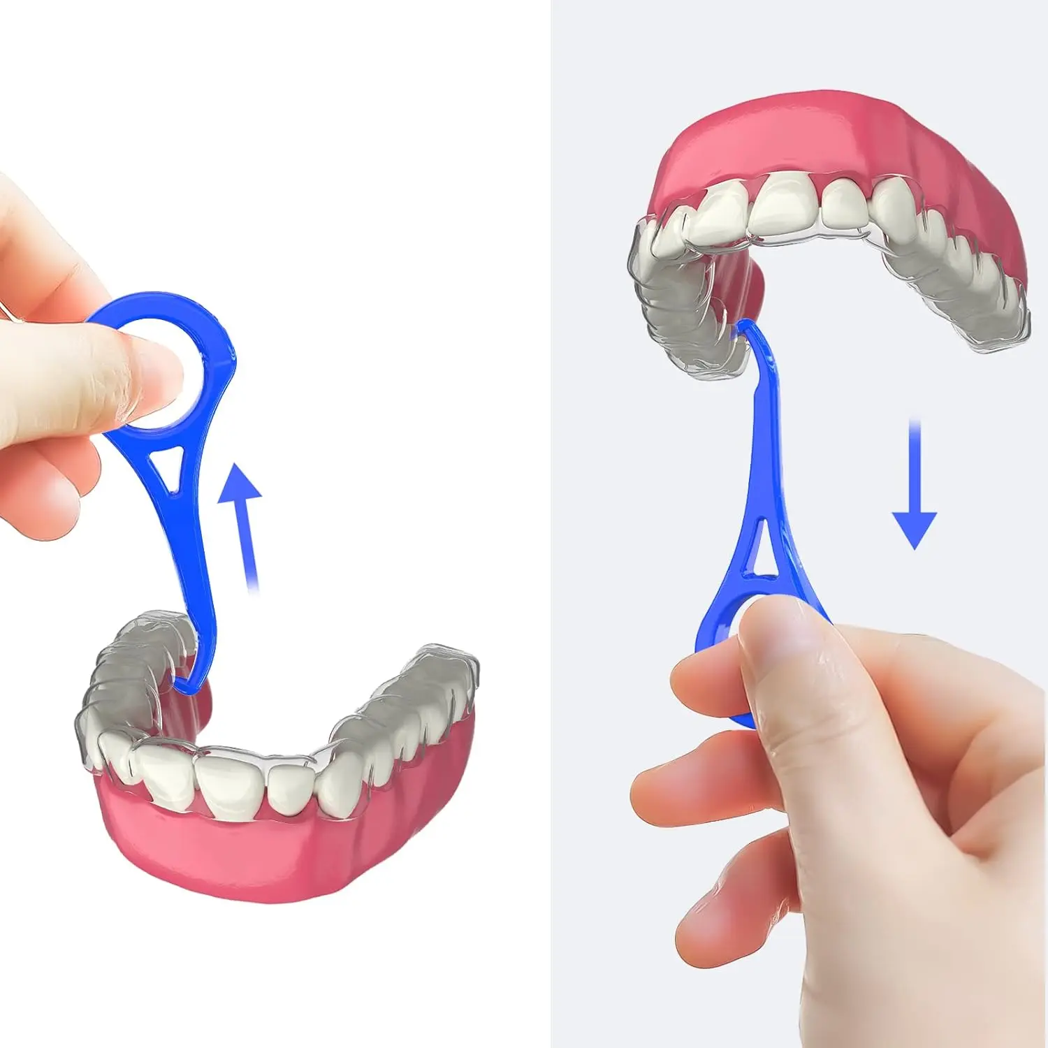 ARGOMAX aligner removal tool in blue, designed for easy and hygienic removal of invisible braces, retainers, and other orthodontic appliances.