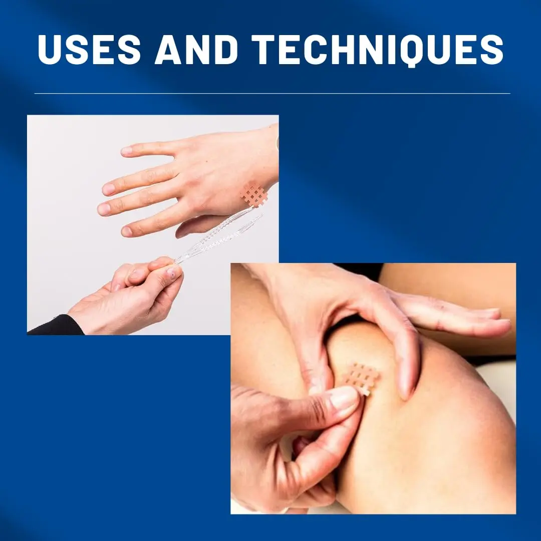 Beige CureTape CrossLinq acupressure patches provide targeted relief for body pain and discomfort, promoting natural scar healing.