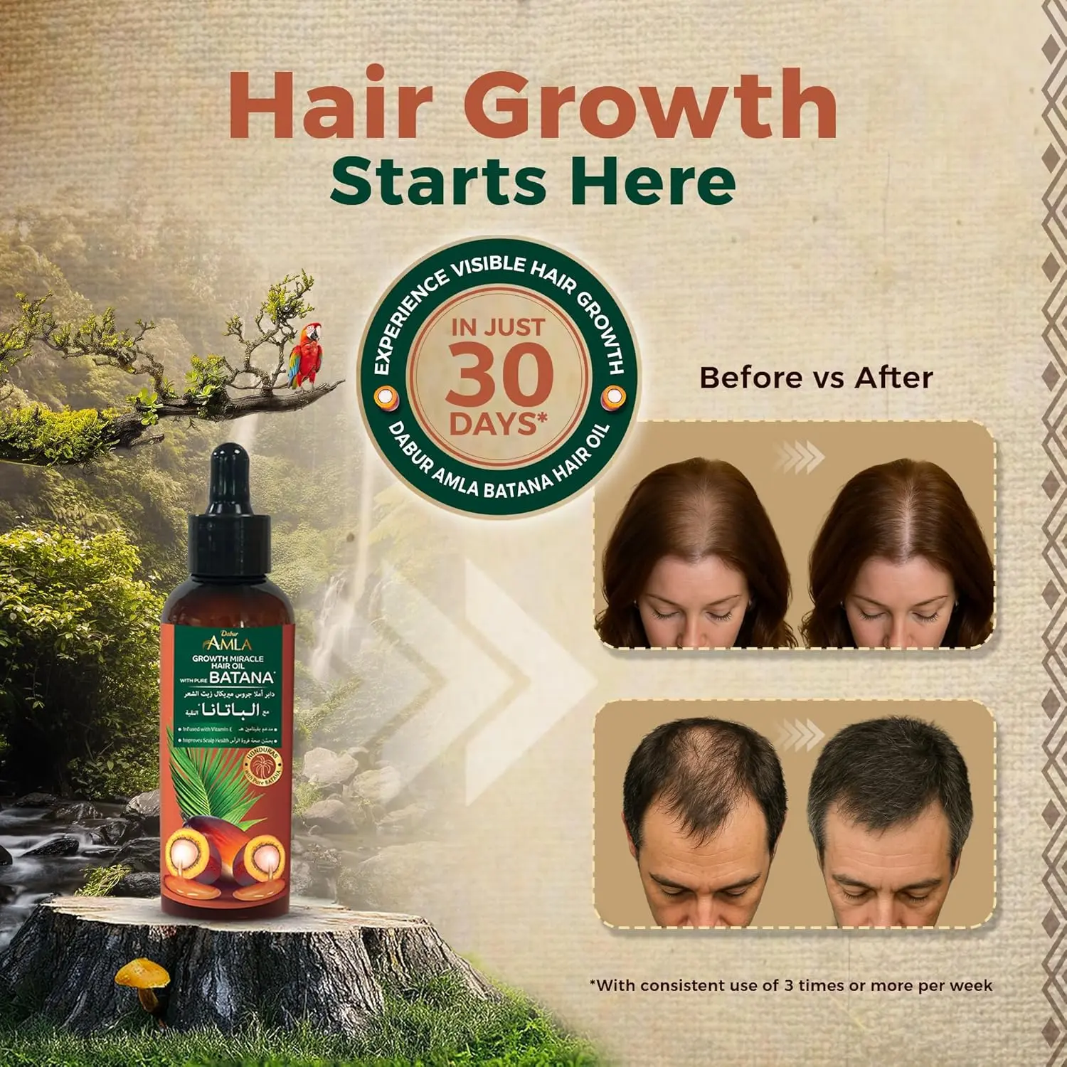 Dabur Amla Batana hair oil with dropper, sourced from Honduras, promotes hair growth, prevents breakage, and improves softness and shine.
