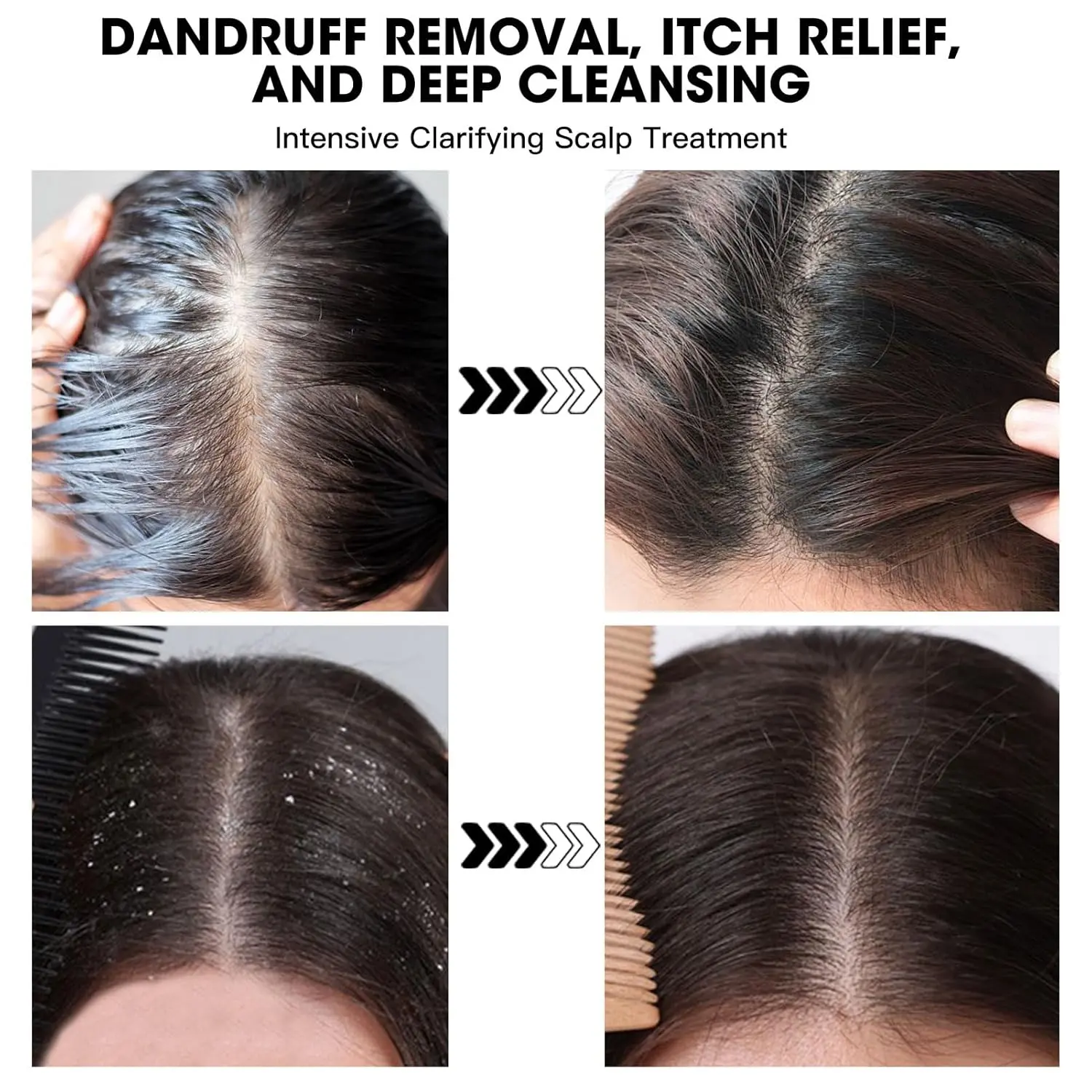 This Dead Sea Salt Scalp Scrub exfoliates and clarifies, providing relief from oily and itchy scalp, dandruff, and build-up, promoting healthier hair.