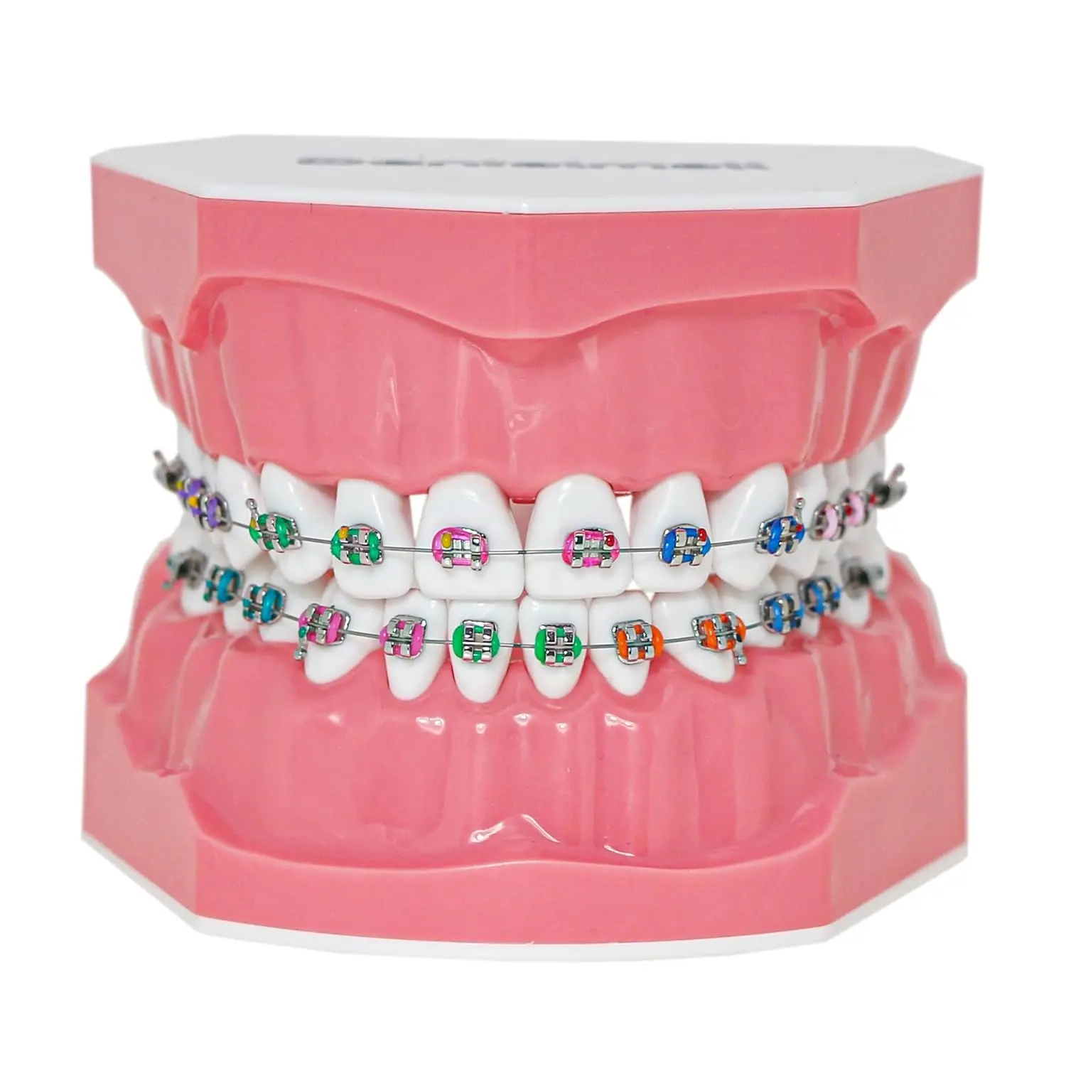 This dental orthodontic model demonstrates teeth with braces, wires, and elastics, ideal for teaching and explaining orthodontic concepts.