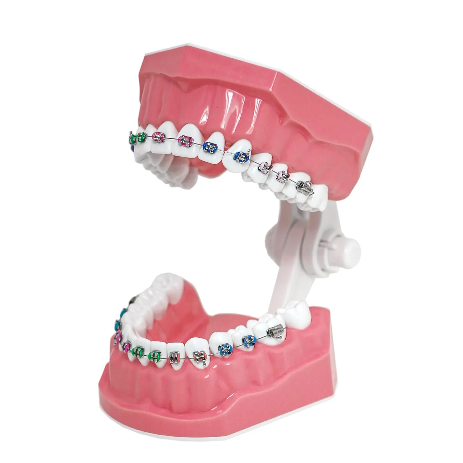 This dental orthodontic model demonstrates teeth with braces, wires, and elastics, ideal for teaching and explaining orthodontic concepts.