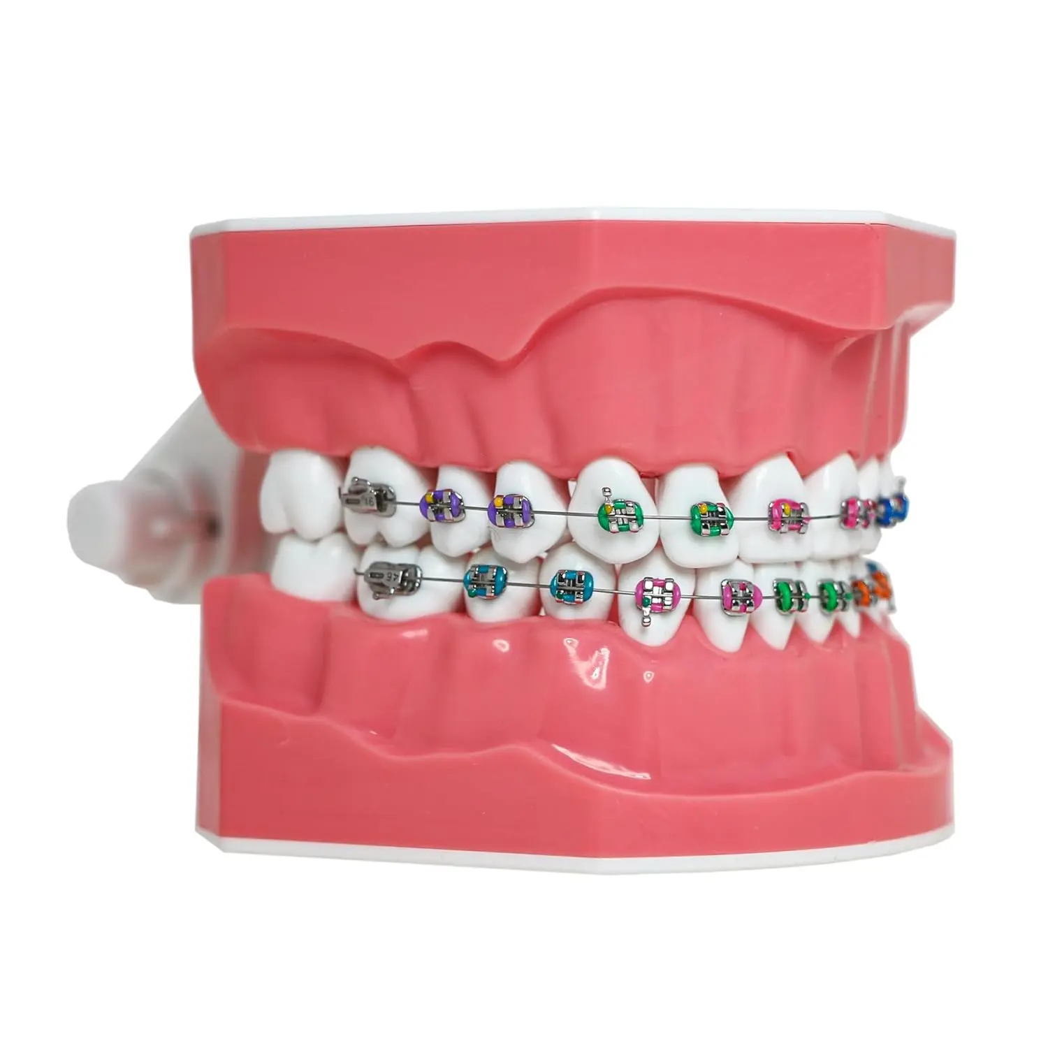 This dental orthodontic model demonstrates teeth with braces, wires, and elastics, ideal for teaching and explaining orthodontic concepts.